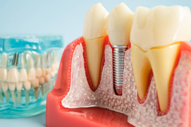 Our Range of Dental Services in Diamond Bar, CA